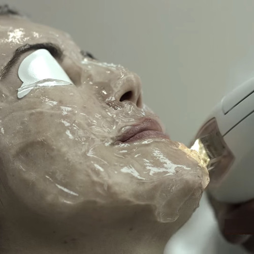 fotorejevenecimiento