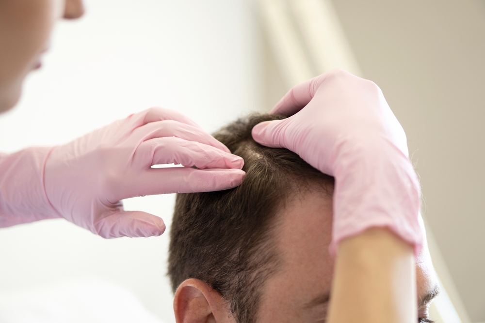 Trichologist,Examining,Scalp,Of,Patient
