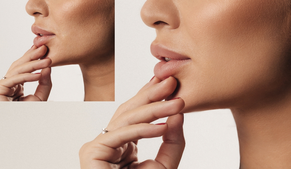 Before,And,After,Close-up,Of,A,European,Woman’s,Face,With