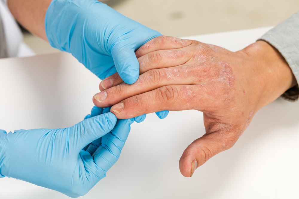 A,Dermatologist,Wearing,Gloves,Examines,The,Skin,Of,A,Sick