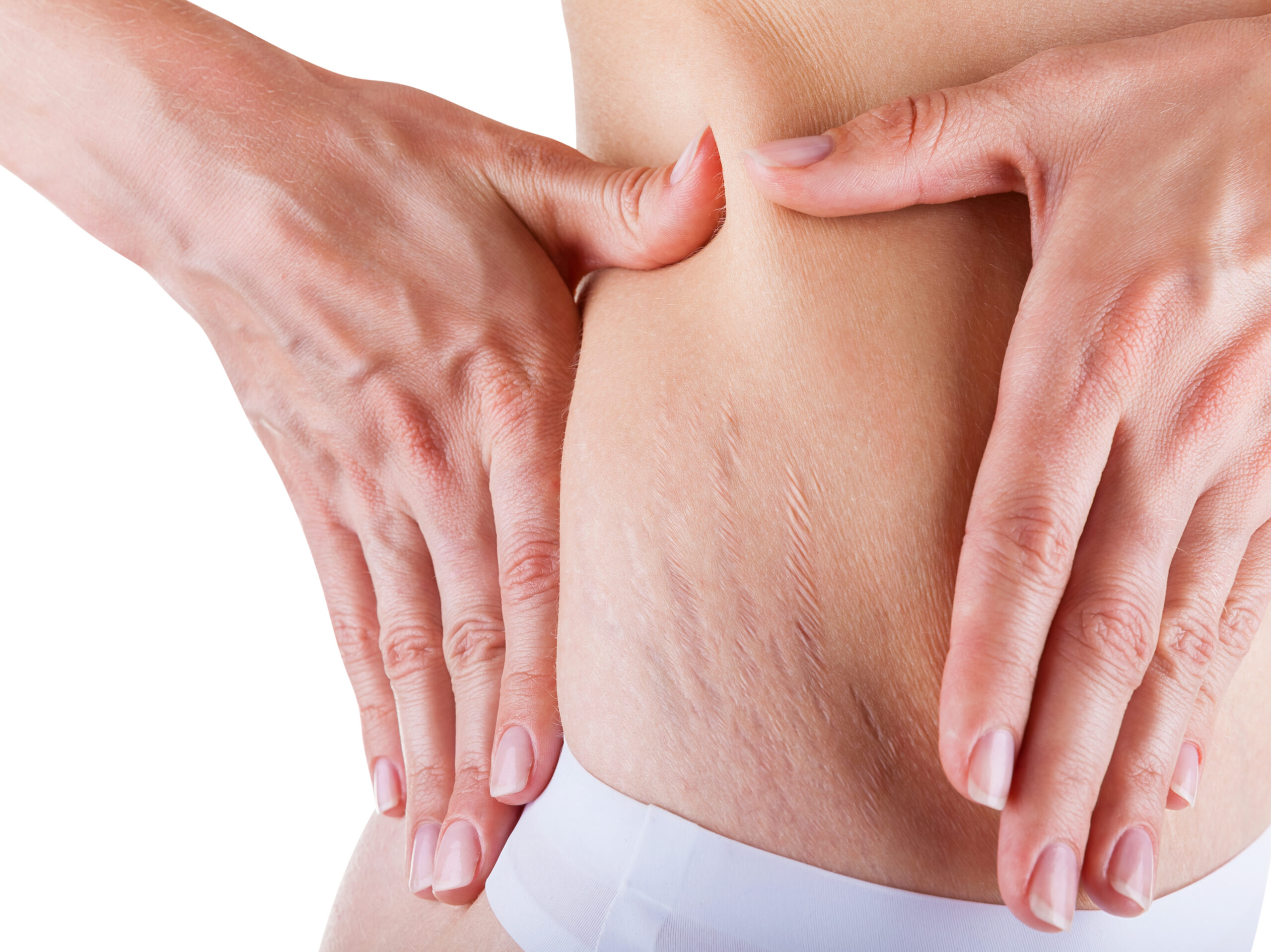 Woman,Is,Testing,The,Skin,On,His,Stomach,On,Broadly,